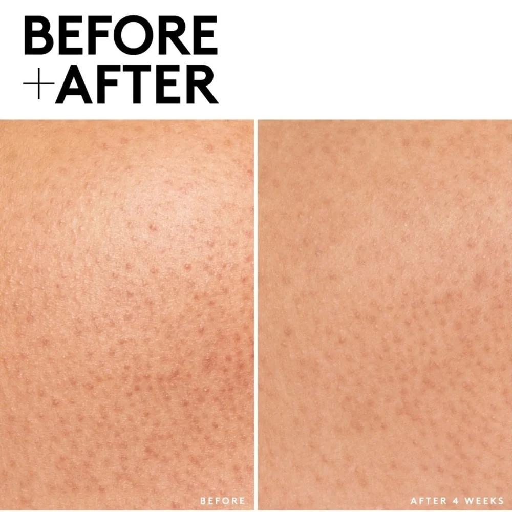 🍒 FENTY SKIN Cherry Dub Triple Action AHA Body Scrub